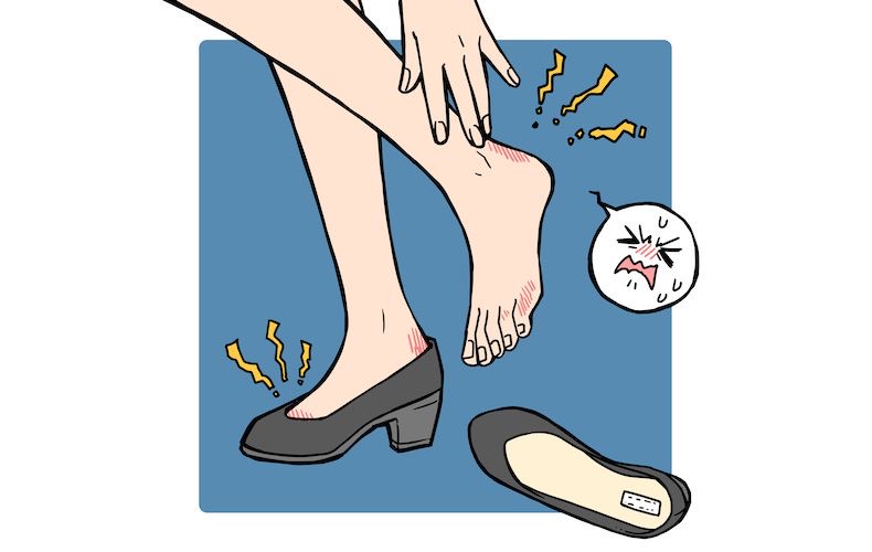 サンダルによる靴擦れの対処法は 予防策や原因 おすすめグッズを紹介 Domani
