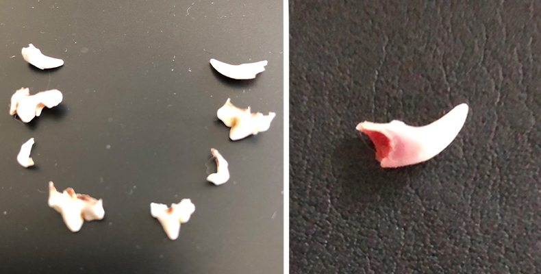 ウツボに噛まれる最も一般的な原因は何ですか?