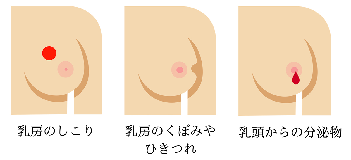 乳房の変化 イラスト