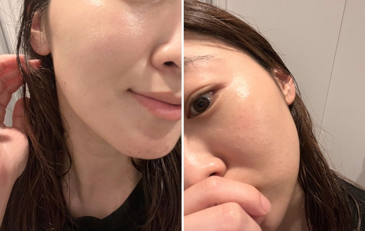 シミの場所の写真