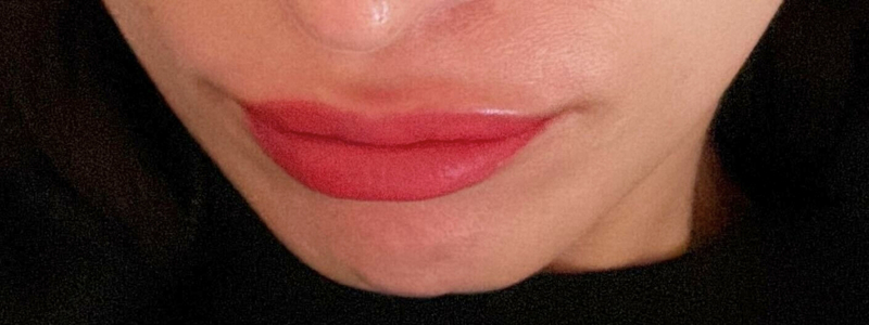 アートメイク施術後の唇の写真