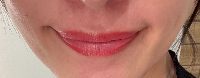 アートメイク施術後の唇の写真